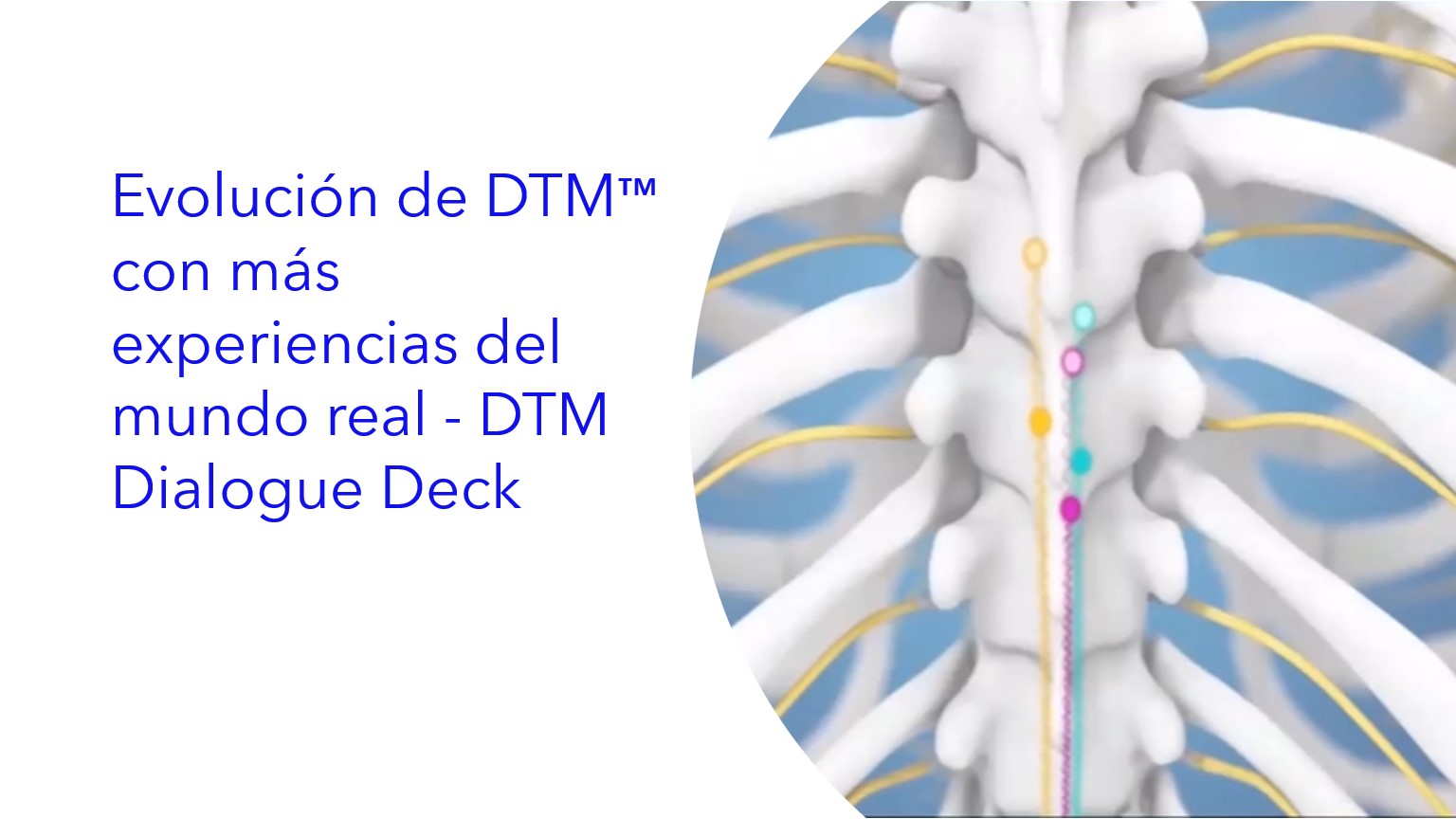 Evolução do DTM™ com mais experiências do mundo real- DTM Dialogue Deck