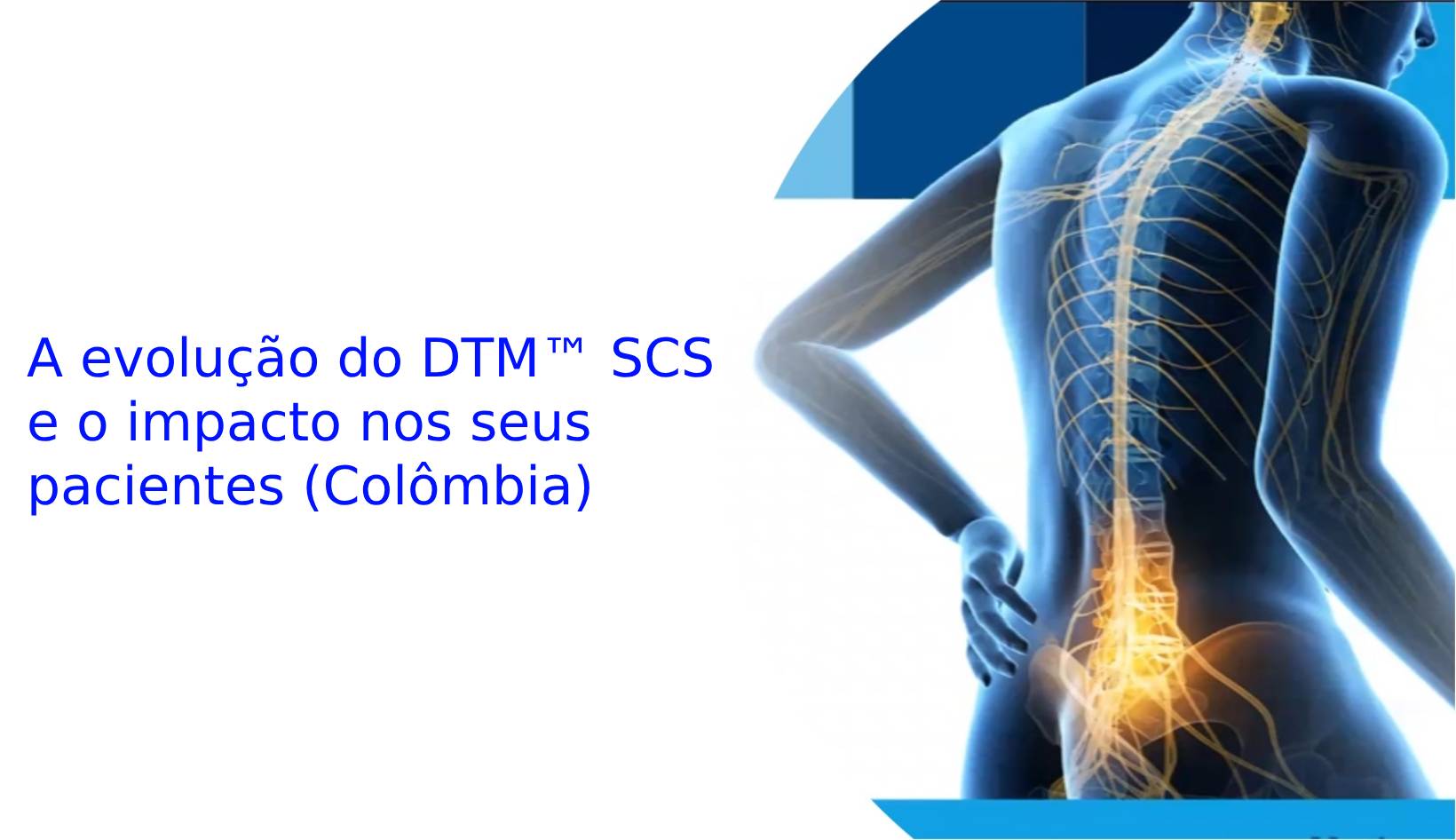 A evolução do DTM™ SCS e o impacto nos seus pacientes (Colômbia)