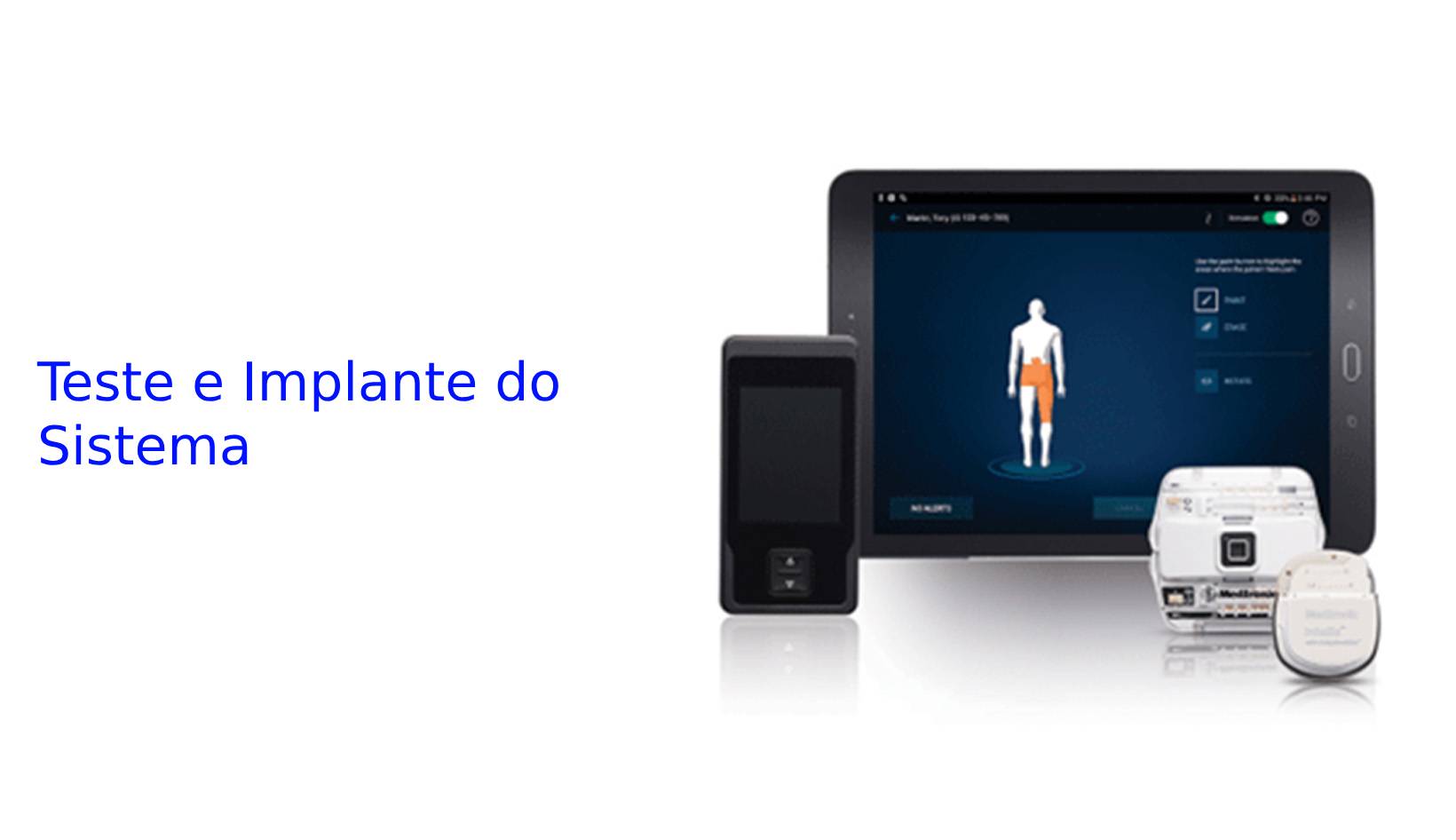Teste e Implante do Sistema.