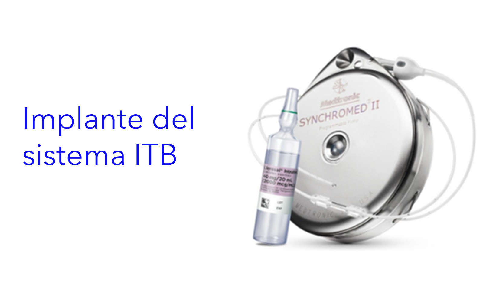 Implante do sistema ITB.