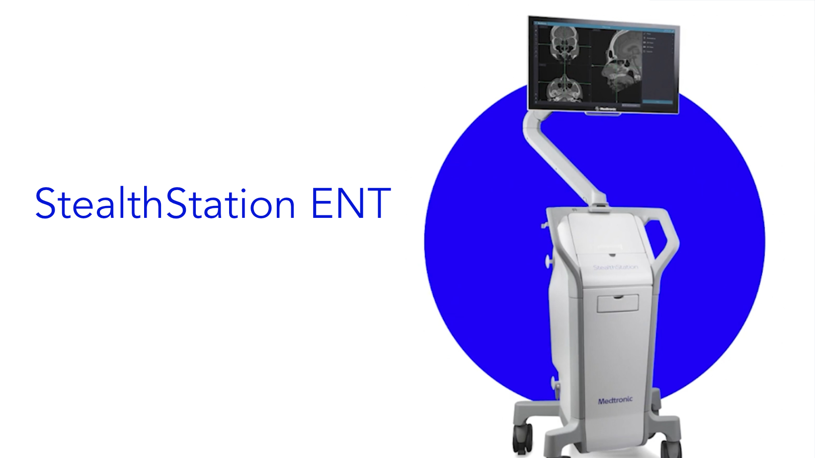 StealthStation ENT