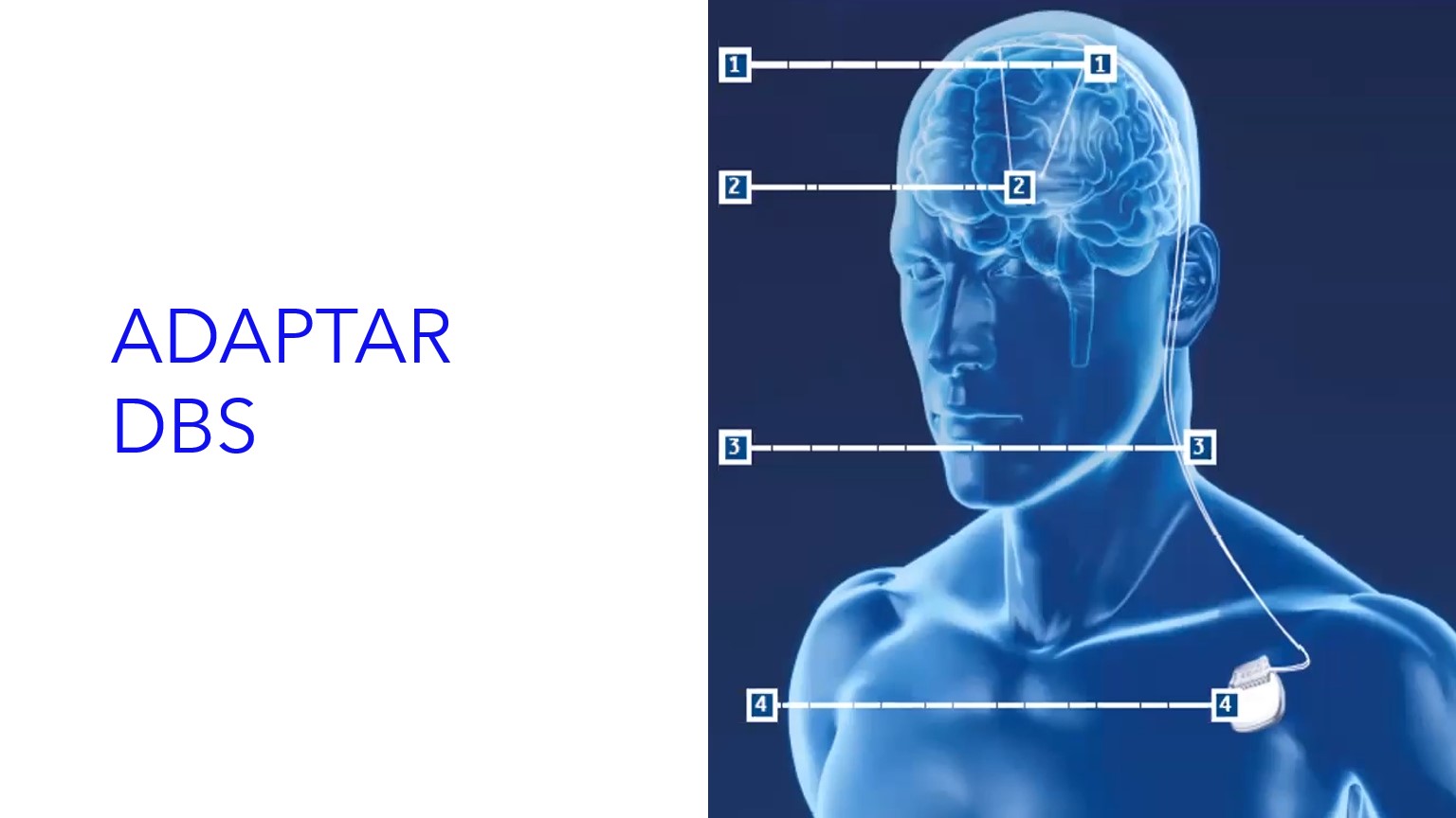 ADAPTAR DBS