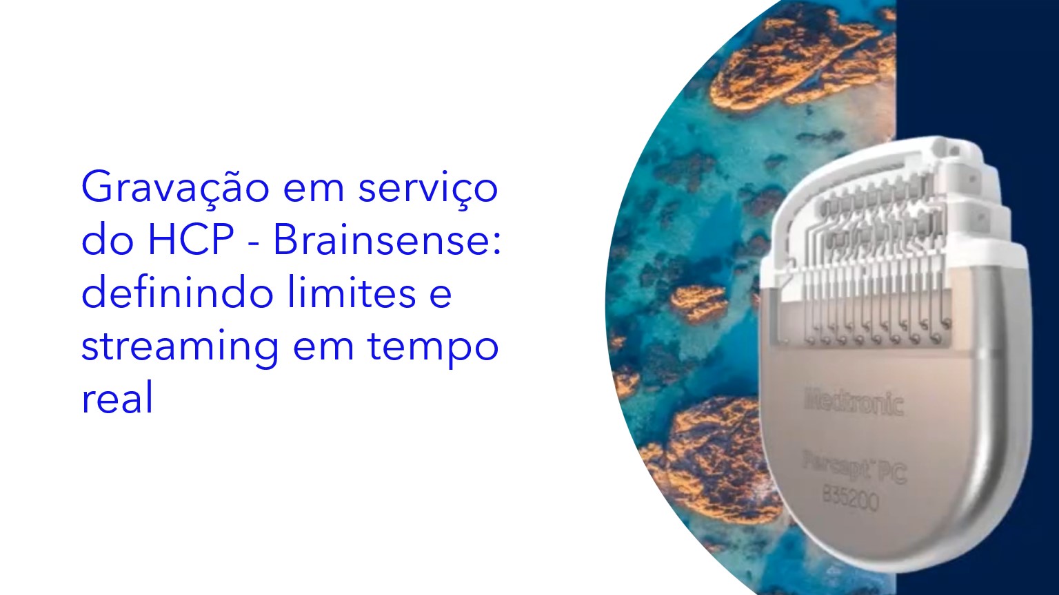 Gravação em serviço do HCP - Brainsense: definindo limites e streaming em tempo real 
