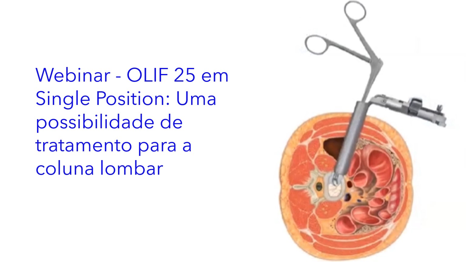 Slide1.jpg